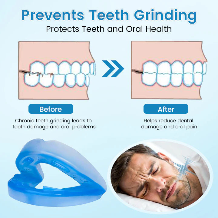 ✨ Adjustable Anti-Snoring Mouthpiece – Universal Fit for Better Sleep 😴✨