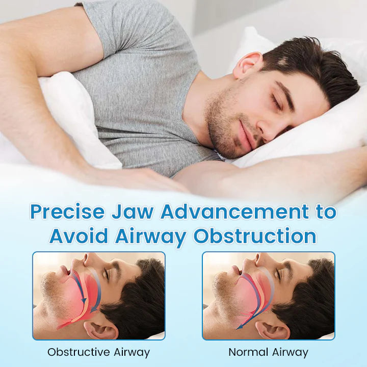 ✨ Adjustable Anti-Snoring Mouthpiece – Universal Fit for Better Sleep 😴✨