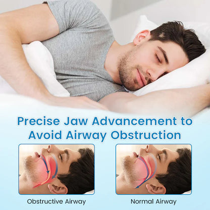 ✨ Adjustable Anti-Snoring Mouthpiece – Universal Fit for Better Sleep 😴✨