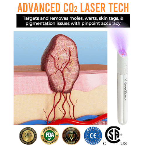 💯QIAWI™ All-in-One CO₂ Laser Eraser Pen | Removes Moles, Warts, Skin Flaws & Pigmentation